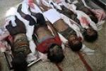جنایت وحشیانه آمریکا و آل‌سعود در یمن/ 60 بیمار و غیرنظامی شهید و 130 نفر زخمی شدند